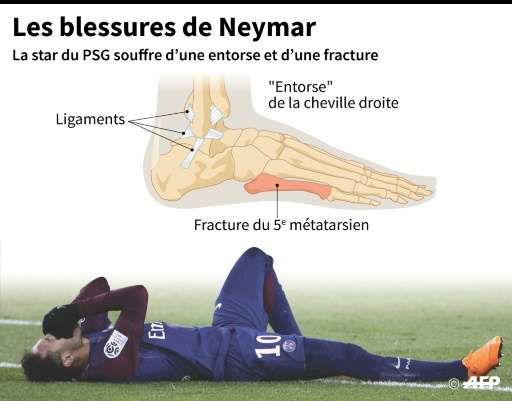 Neymar opéré samedi, compte à rebours avant la Coupe du monde