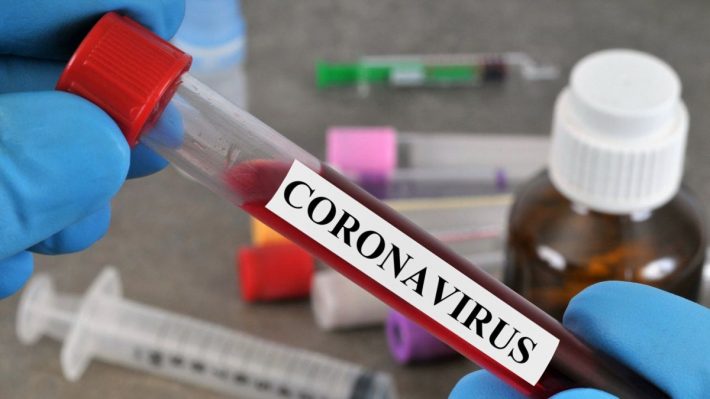 CHAN 2020: Un test de coronavirus avant d’entrer au Cameroun !